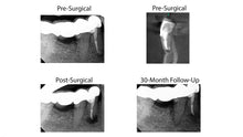 Load image into Gallery viewer, Jun 2025 through Jun 2026 - Endo mini-residency program