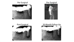 Jun 2025 through Jun 2026 - Endo mini-residency program