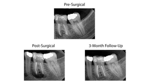 Jan 2025 through Jan 2026 - Endo mini-residency program