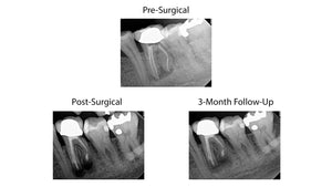 Jan 2025 through Jan 2026 - Endo mini-residency program