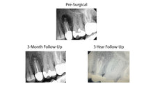 Load image into Gallery viewer, Jun 2025 through Jun 2026 - Endo mini-residency program