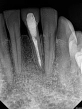 Load image into Gallery viewer, [ENDODONTISTS TRACK] Laser-Assisted Apical Micro-Surgery